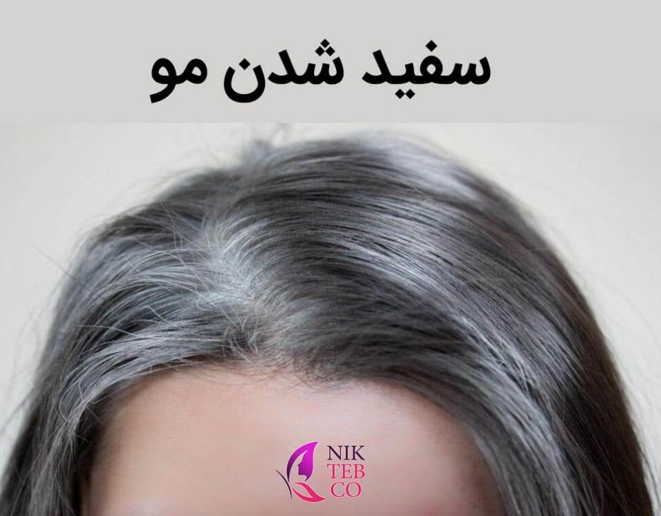سفید شدن مو